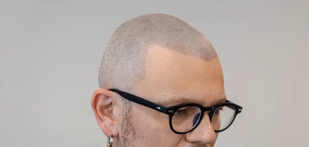 Haarpigmentierung