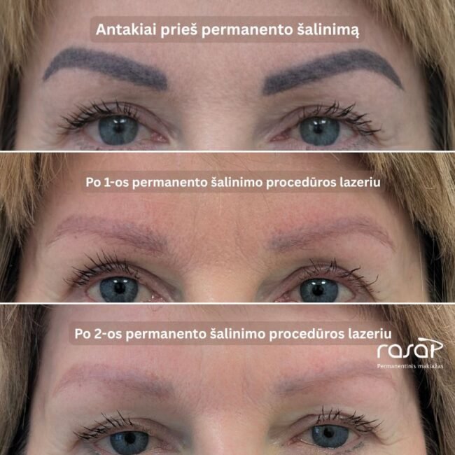 3 moterų antakių nuotraukos. Kur antakiai labai tansūs ir labai šviesūs.