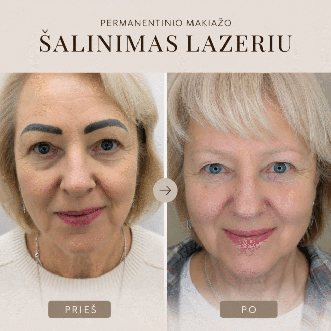 nuotraukoje dvi vyresnio amziaus, blondinės moterys viena su juodais antakiais kita su sviesiais