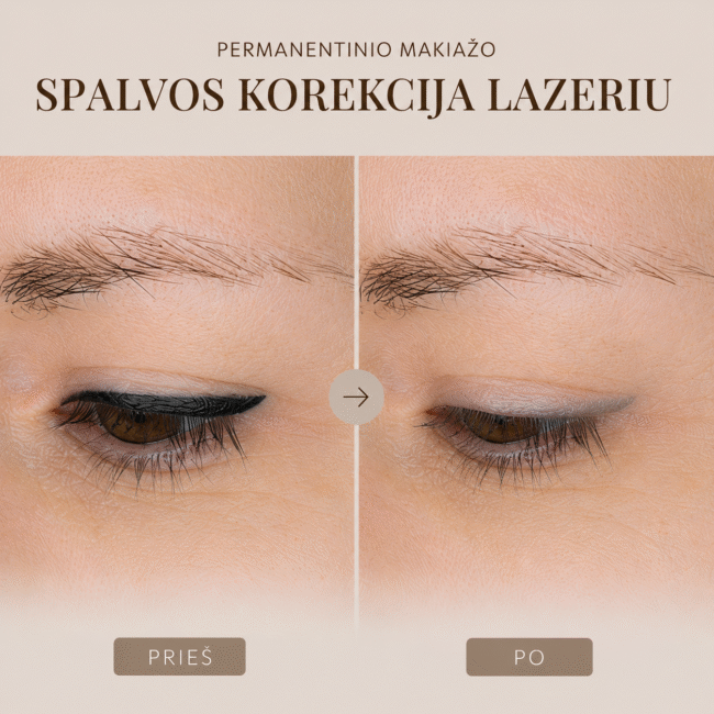 closeup of eye. With thick black eyeliner and no eyeliner
