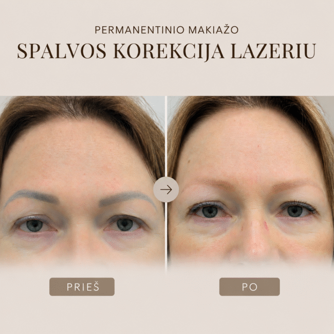 In the picture portrais of women wit dark eyebrows and linght. With text permanent makeup color corectior with laser